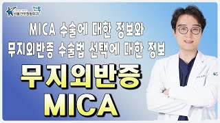 MICA수술