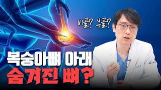 계속 아픈 복숭아뼈... 원인은