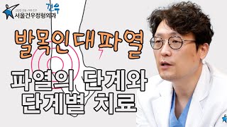 발목인대파열 수술이 꼭 필요할까